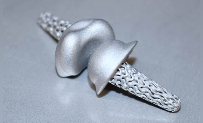 جوڑوں کا درد