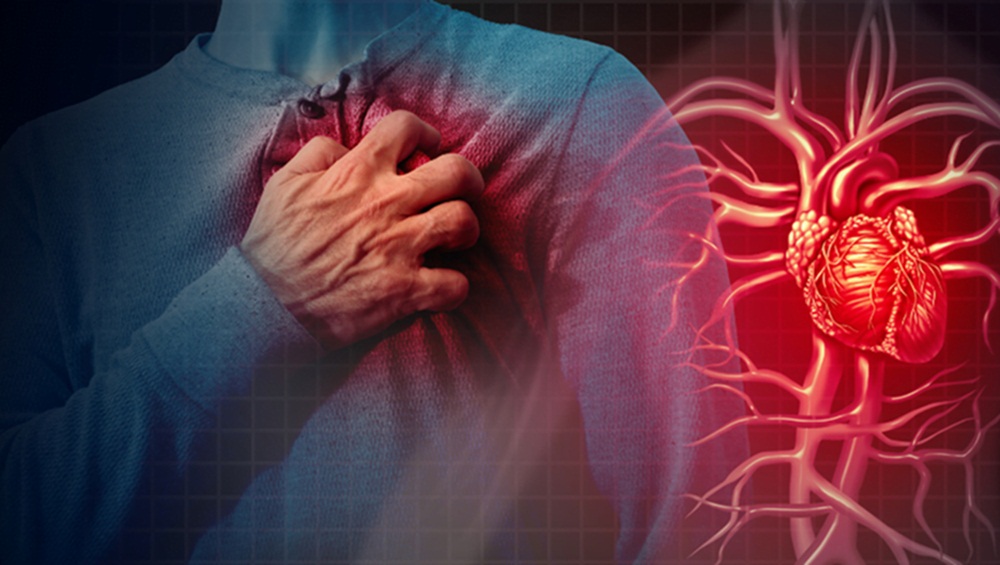 پیر کے روز دل کا دورہ پڑنے کے امکانات 13 فیصد زیادہ ہوتے ہیں۔ فائل فوٹو